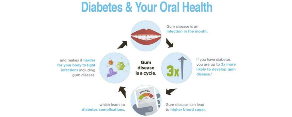 diabetes and oral health infographic