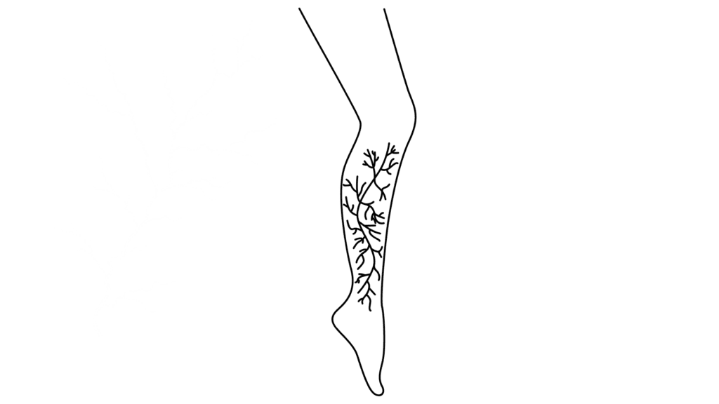 drawing of a leg with veins