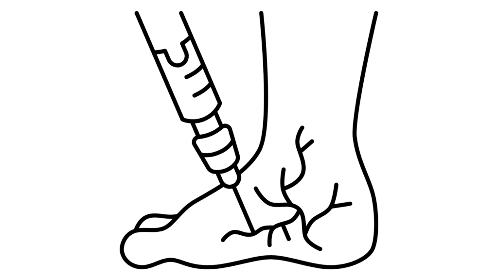 drawing of syringe in foot veins