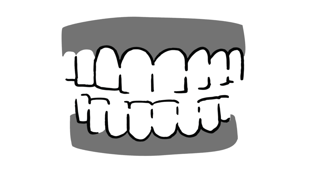 cartoon dentures