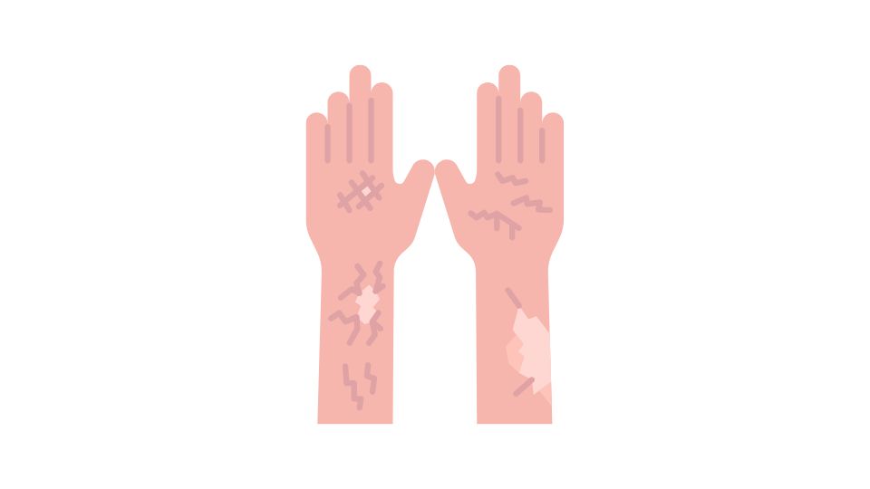 body skin